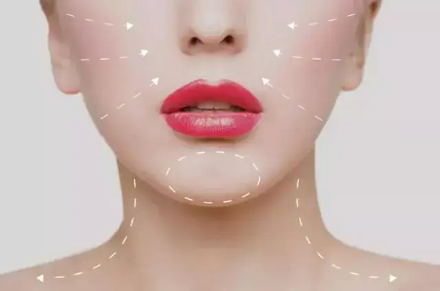 Tarsus’ta Doğal Dudak Tasarımı: Yapay Zeka ile “Ördek Dudak” Görünümüne Son!